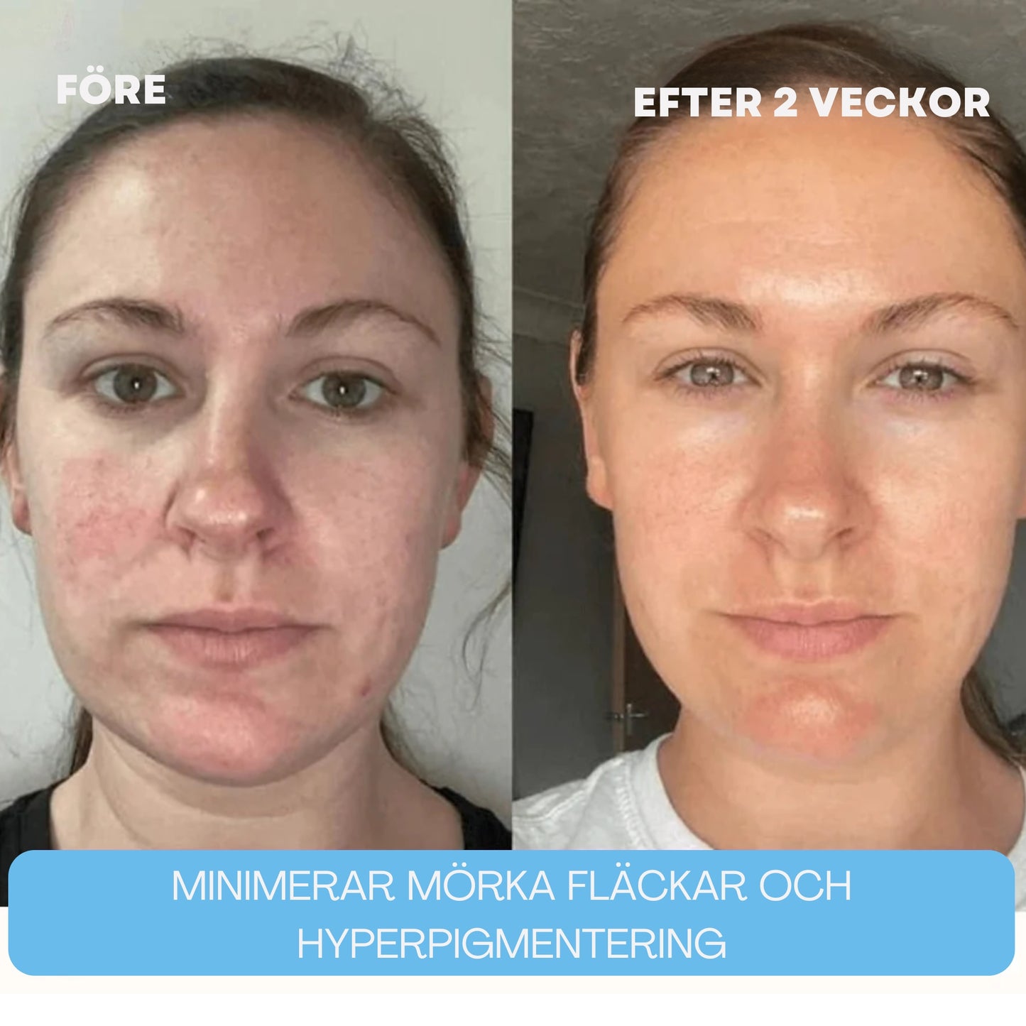 Djupt Återfuktande Kollagen Sheet Mask